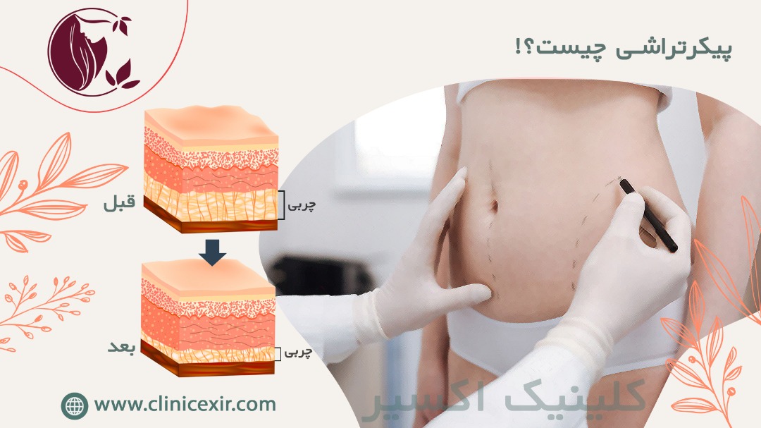 پیکرتراشی چیست؟!