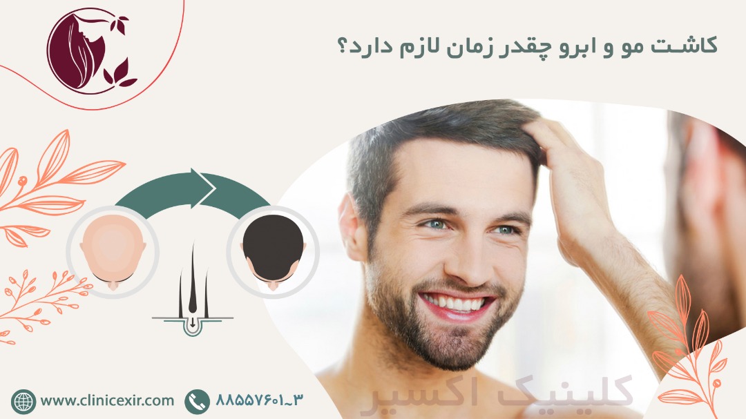کاشت مو و ابرو چقدر زمان لازم دارد؟