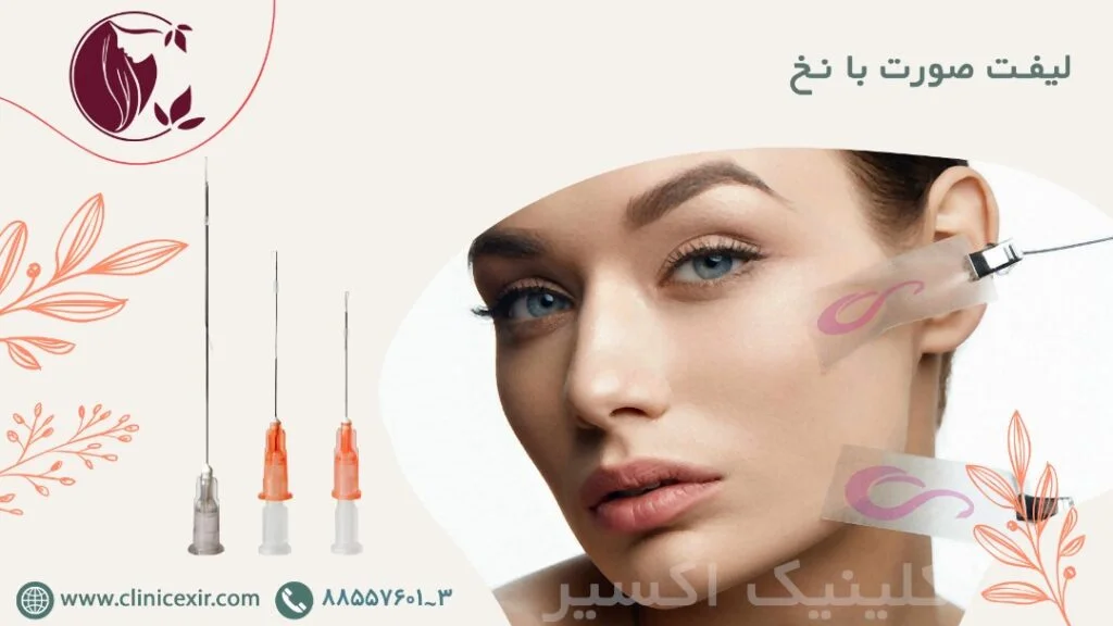 لیفت با نخ
