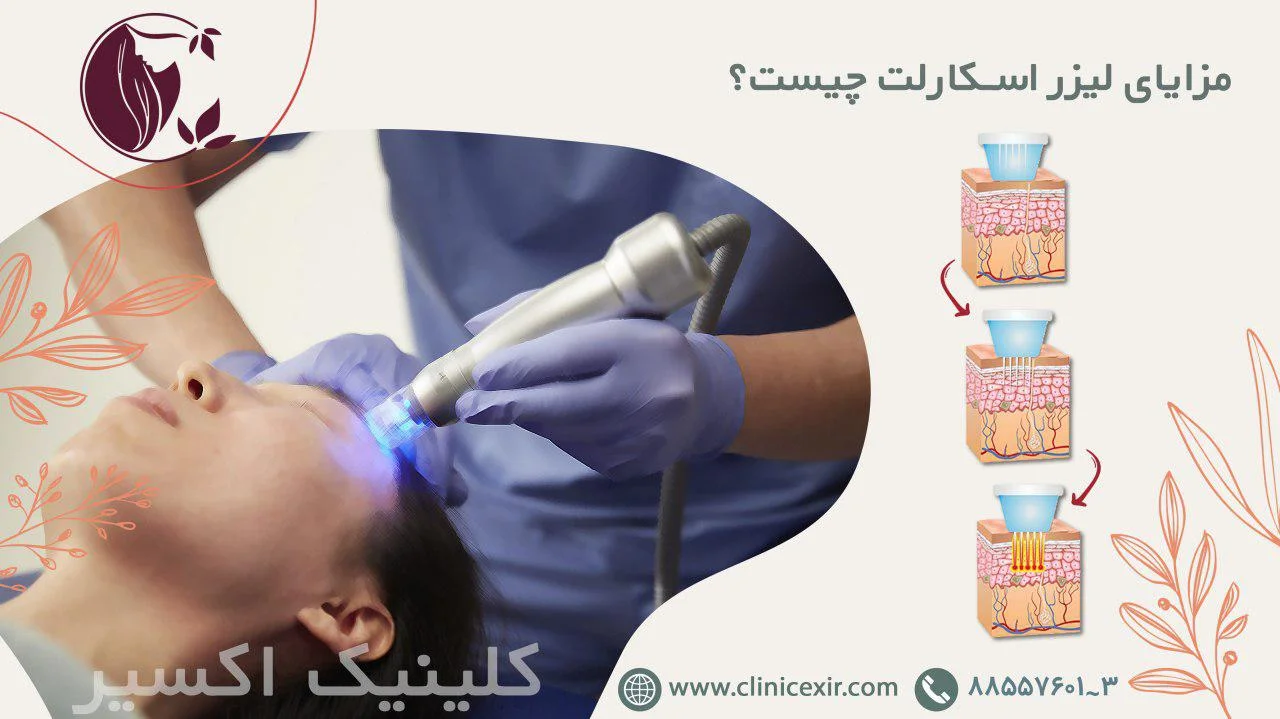 کاربردهای آر اف فرکشنال