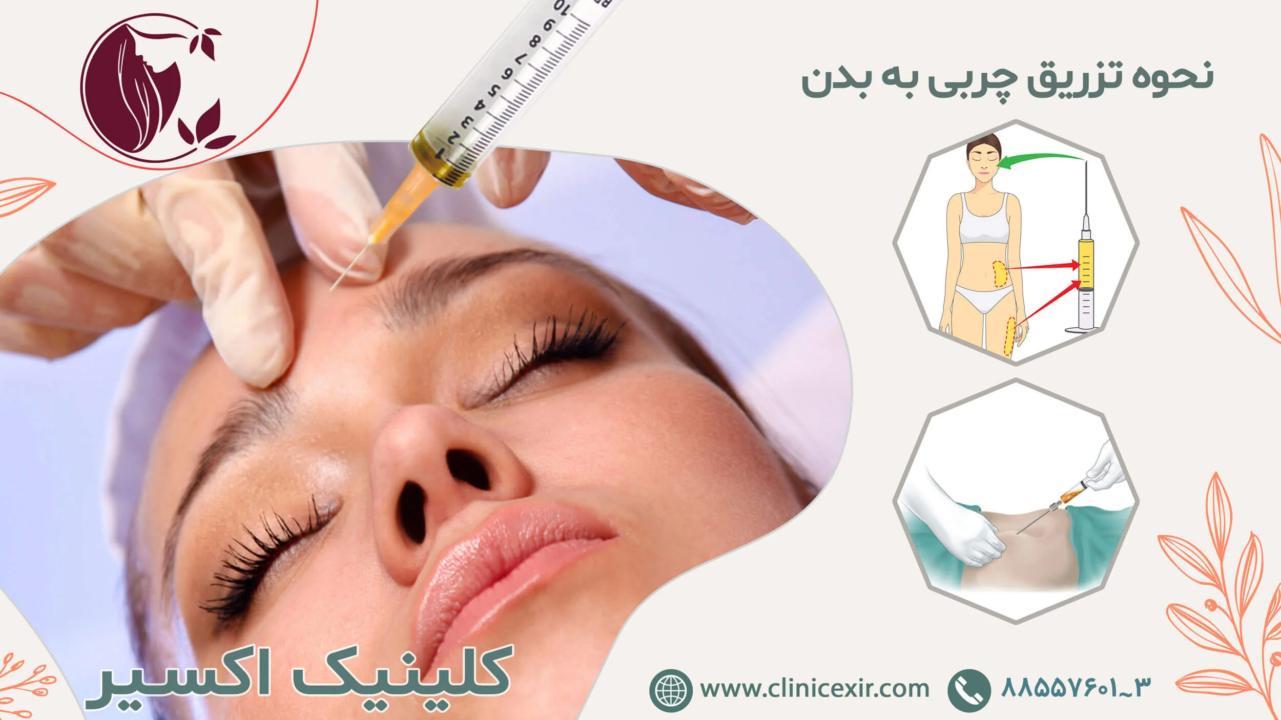 نحوه تزریق چربی تزریق چربی دائمی