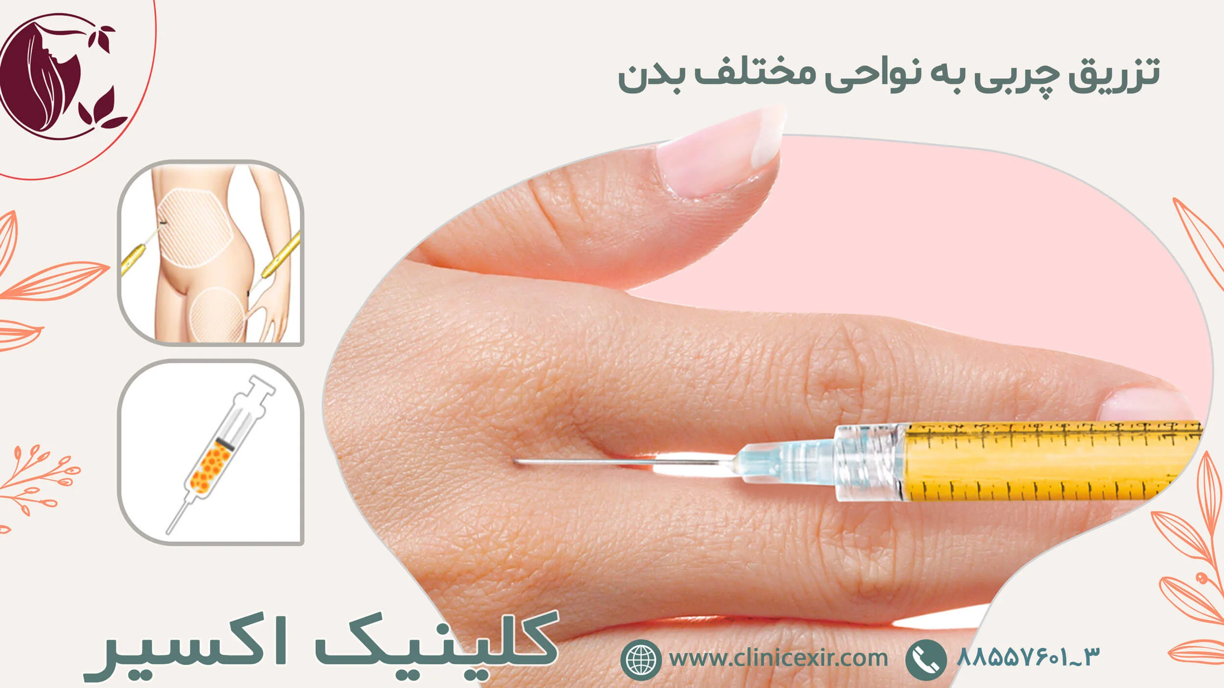 تزریق چربی به نواحی مختلف بدن تزریق چربی دائمی
