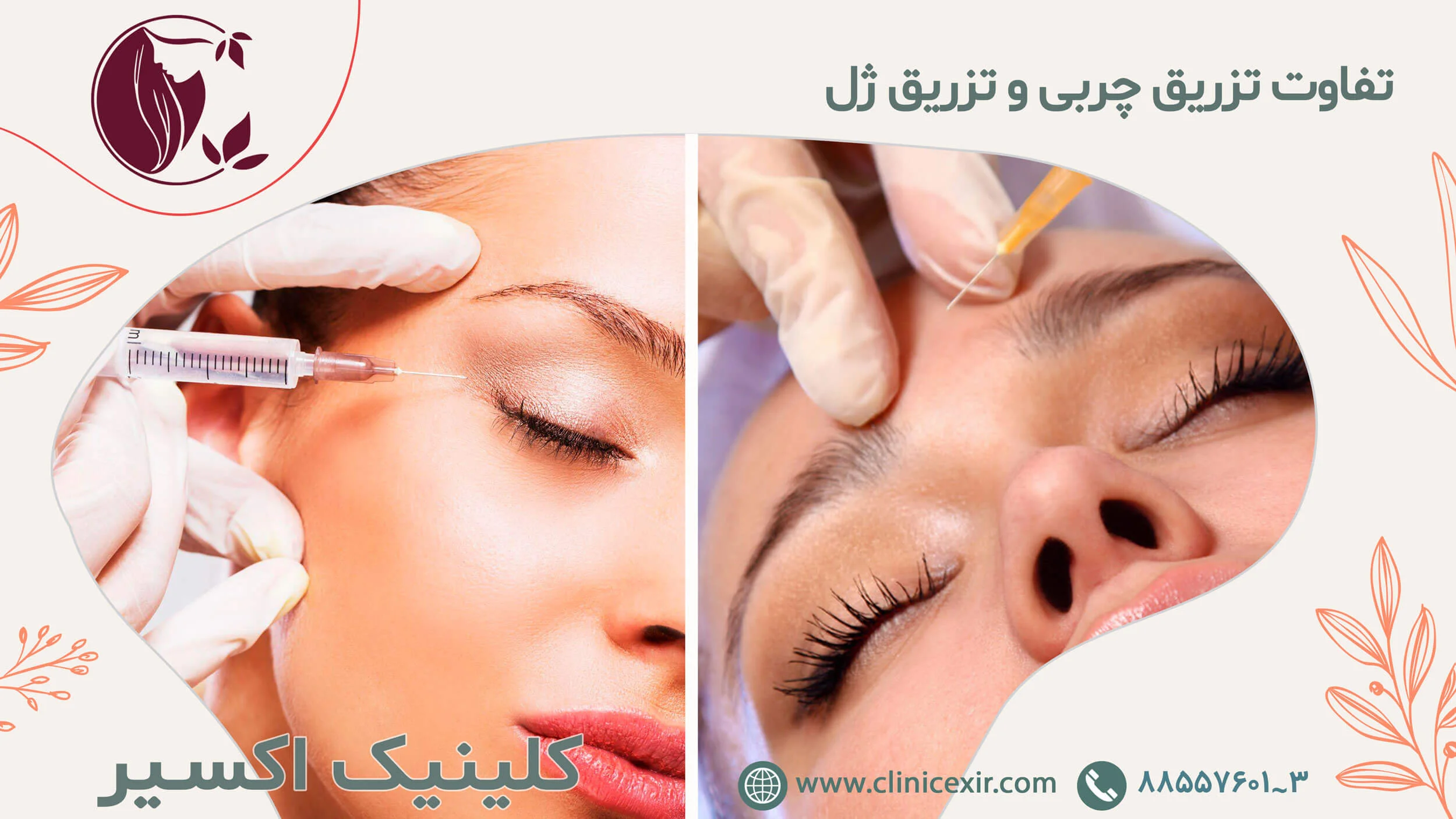تفاوت تزریق چربی و تزریق ژل تزریق چربی دائمی