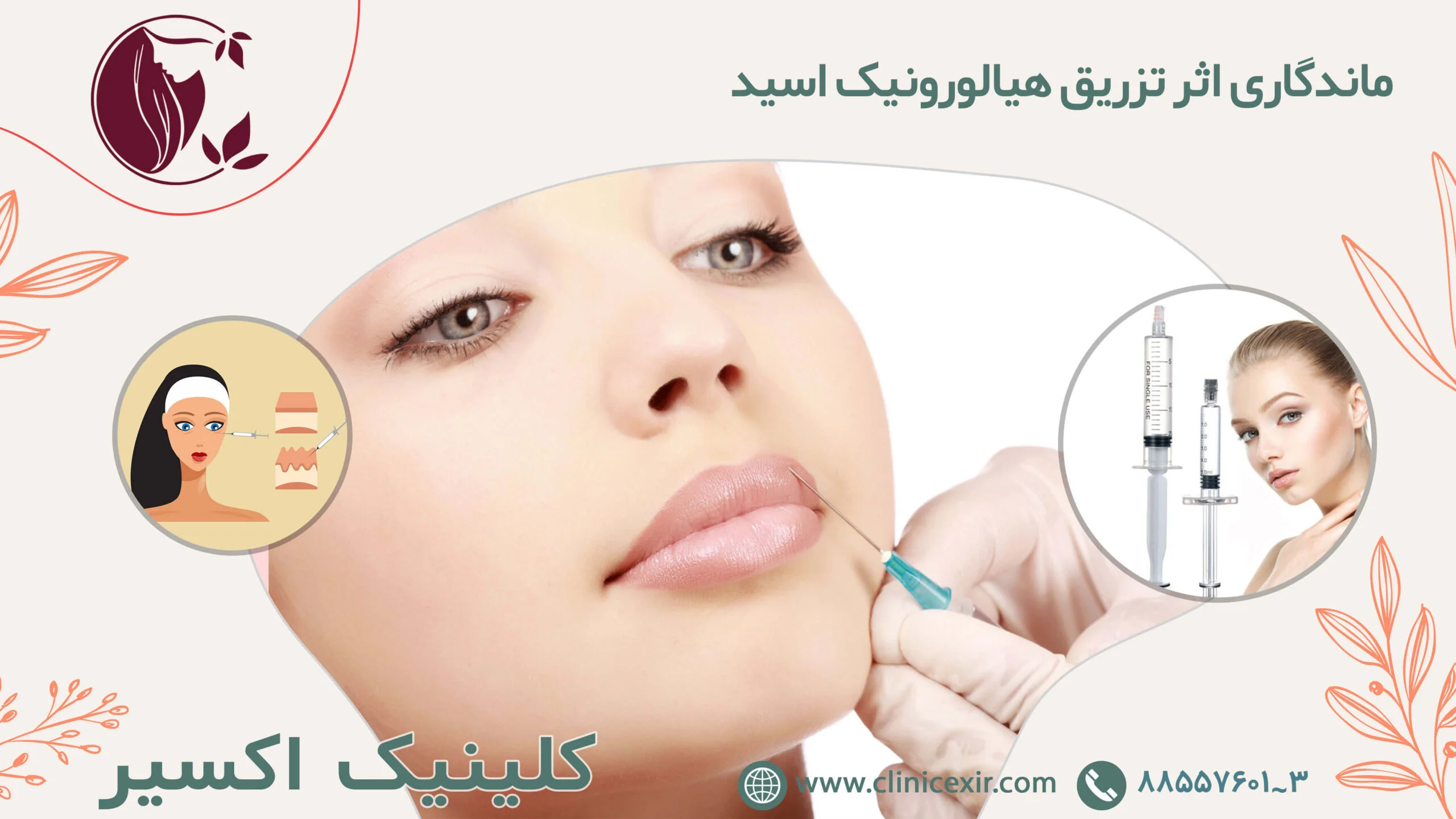 ماندگاری اثر هیالورونیک اسید