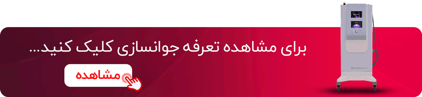 تعرفه جوانسازی
