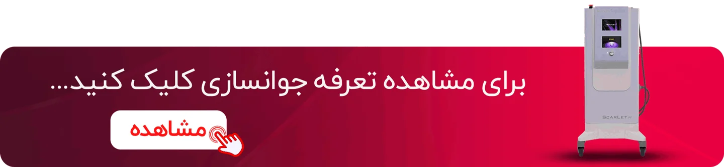 تعرفه جوانسازی