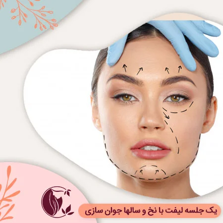 لیفت با نخ ؛ کشیدگی پوست با نخ