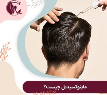 ماینوکسیدیل