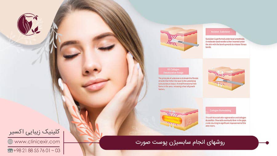 روشهای انجام سابسیژن پوست صورت