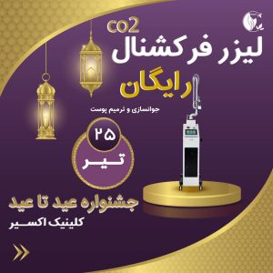 لیزر فرکشنال