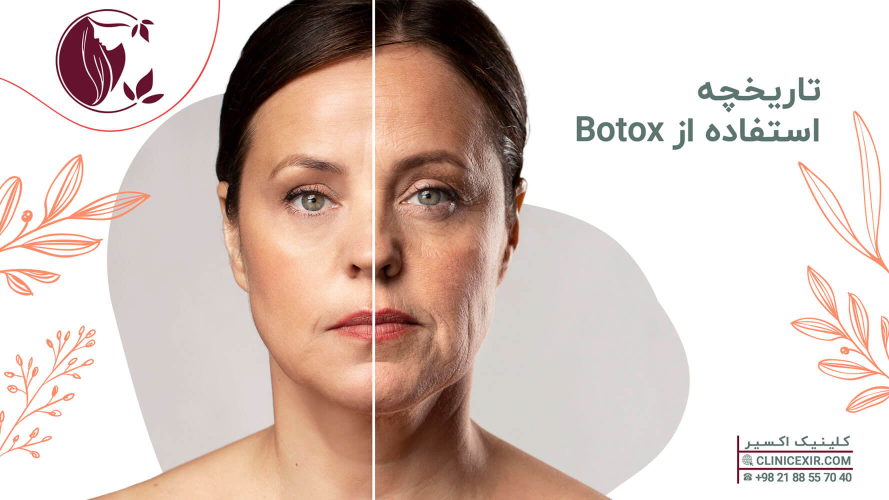 تاریخچه استفاده از Botox 