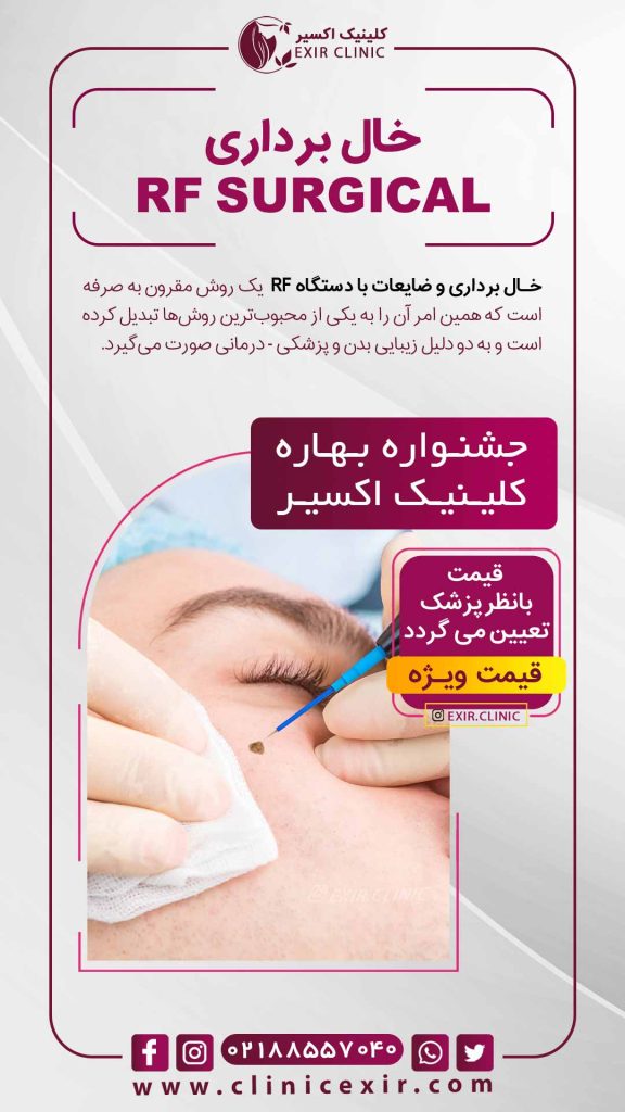 هزینه خالبرداری