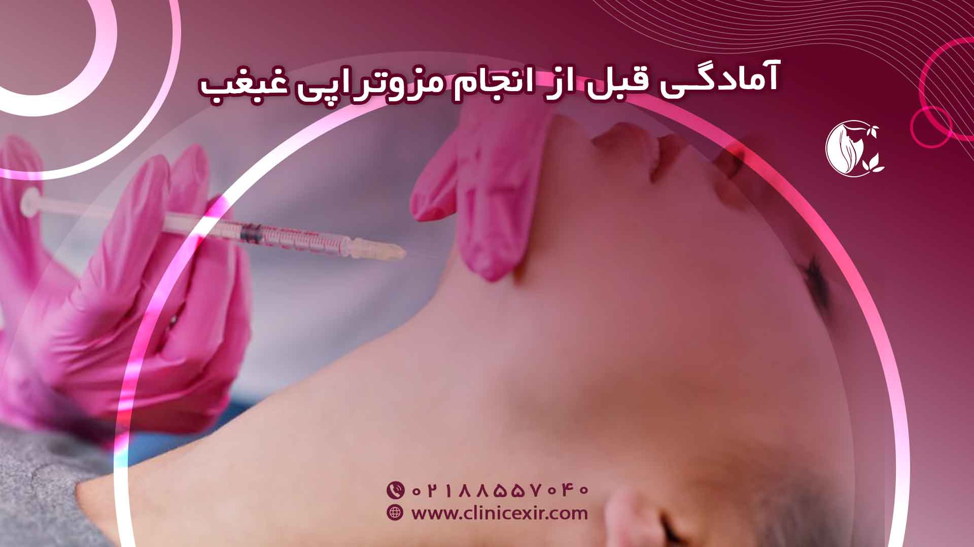 آمادگی قبل از انجام مزوتراپی غبغب
