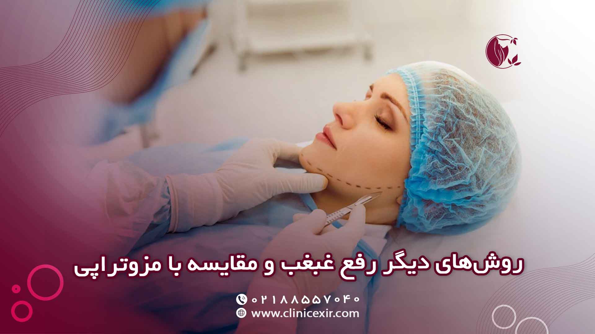 رفع غبغب و مقایسه با مزوتراپی
