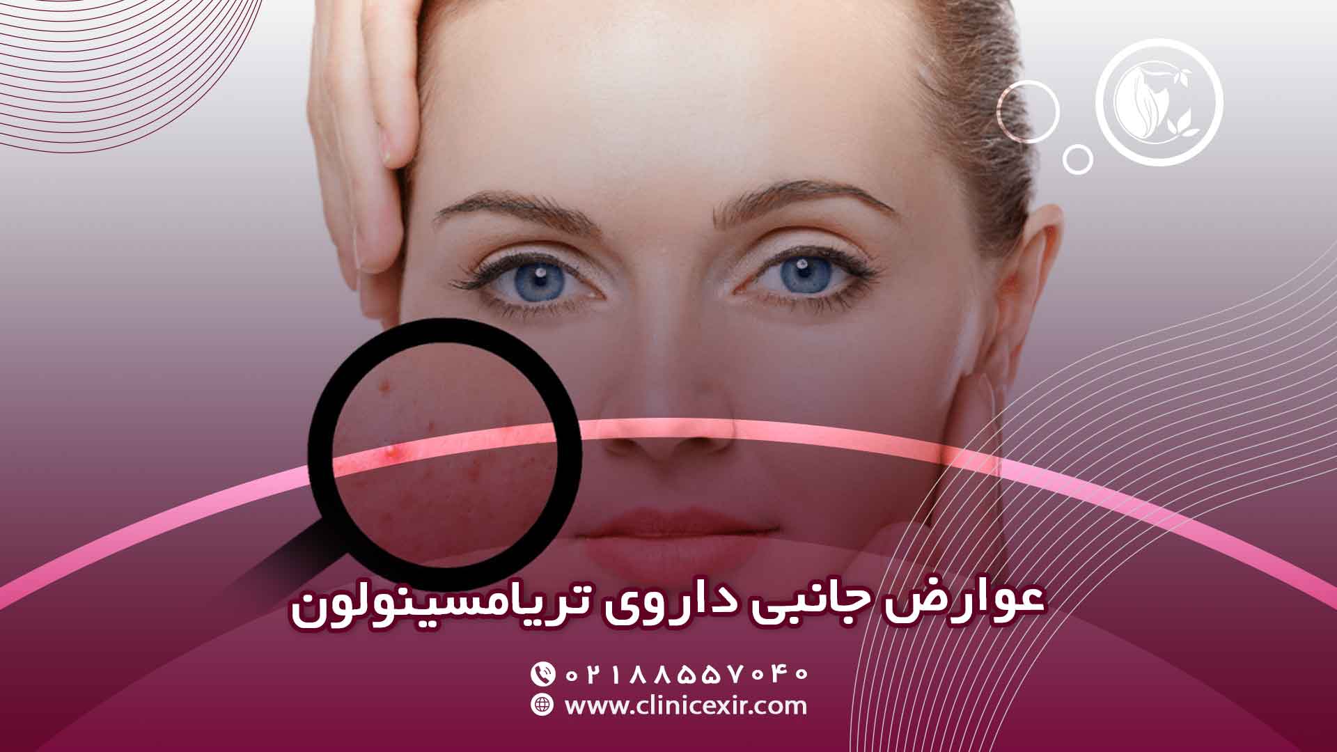عوارض داروی تریامسینولون
