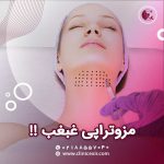 مزو غبغب