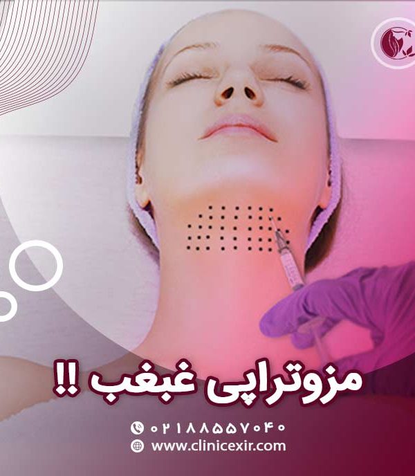 مزو غبغب