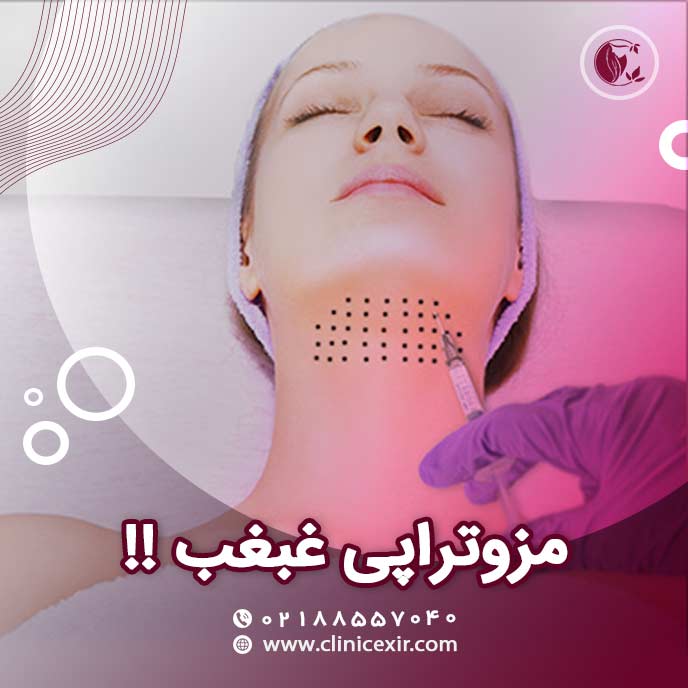 مزو غبغب