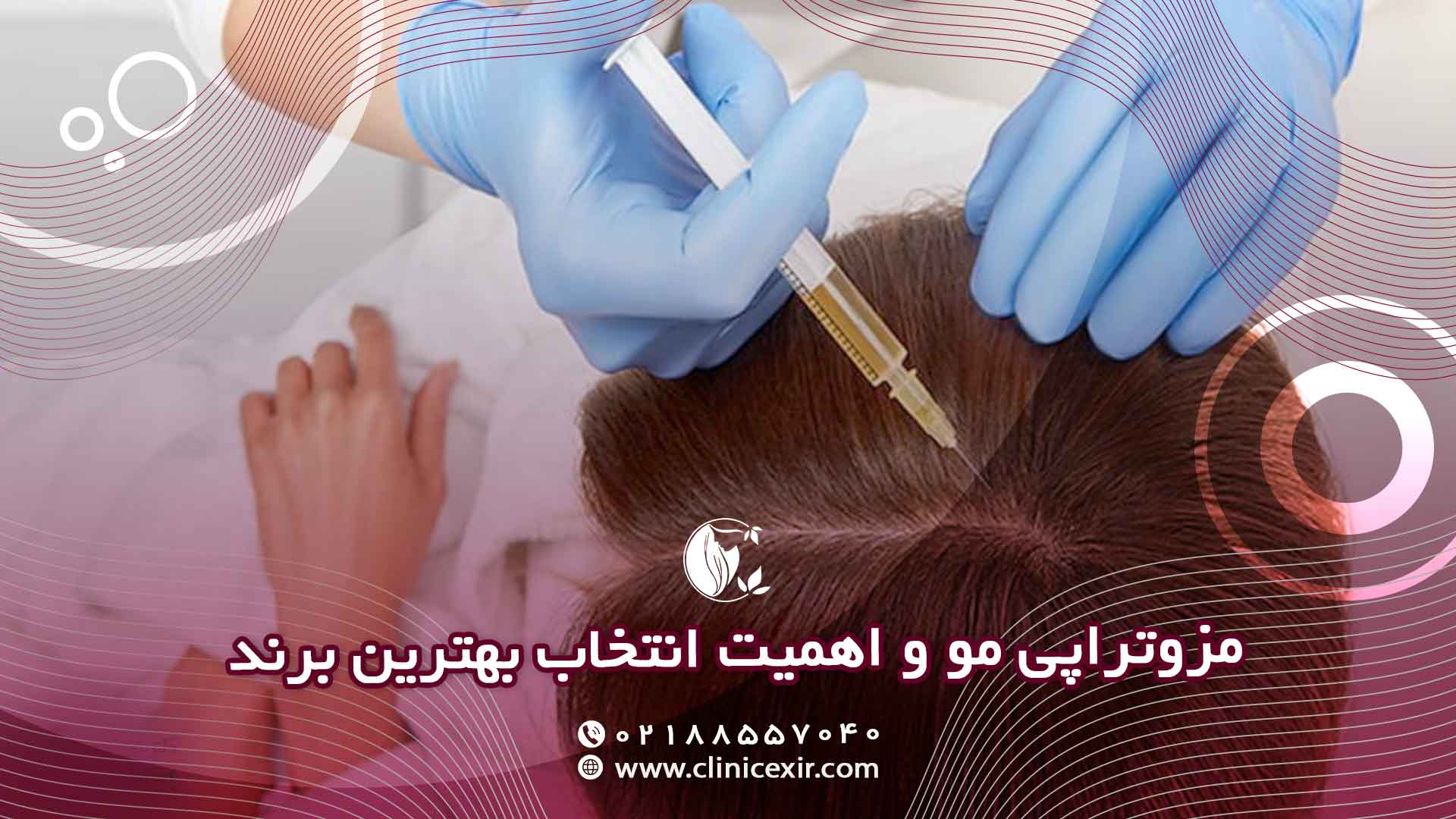 مزوتراپی مو چیست؟
