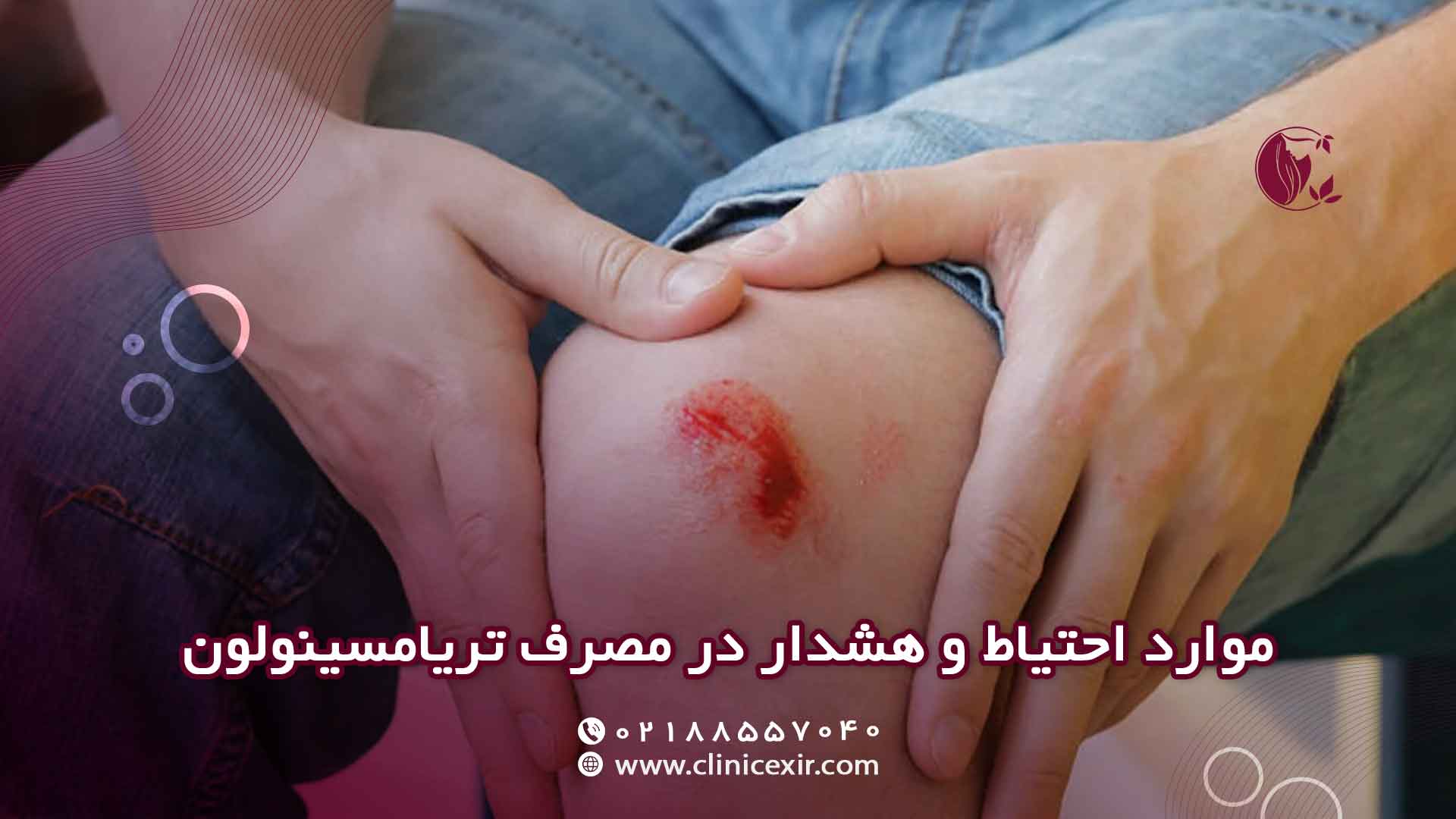 موارد احتیاط در مصرف تریامسینولون