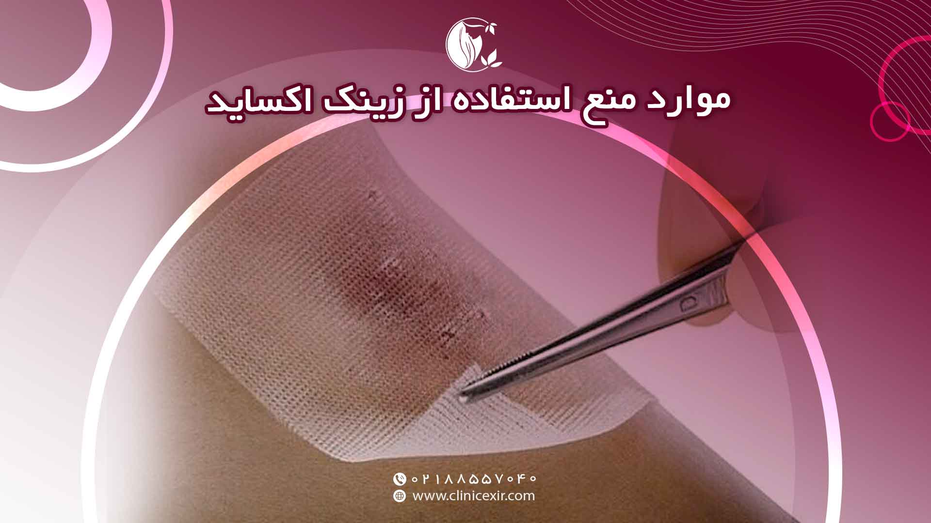 موارد منع استفاده از زینک
