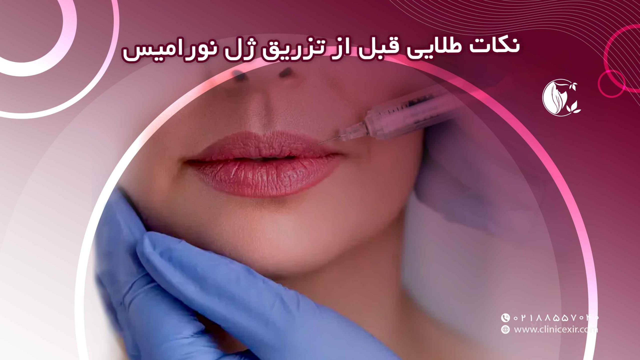 نکات طلایی قبل از تزریق ژل نورامیس