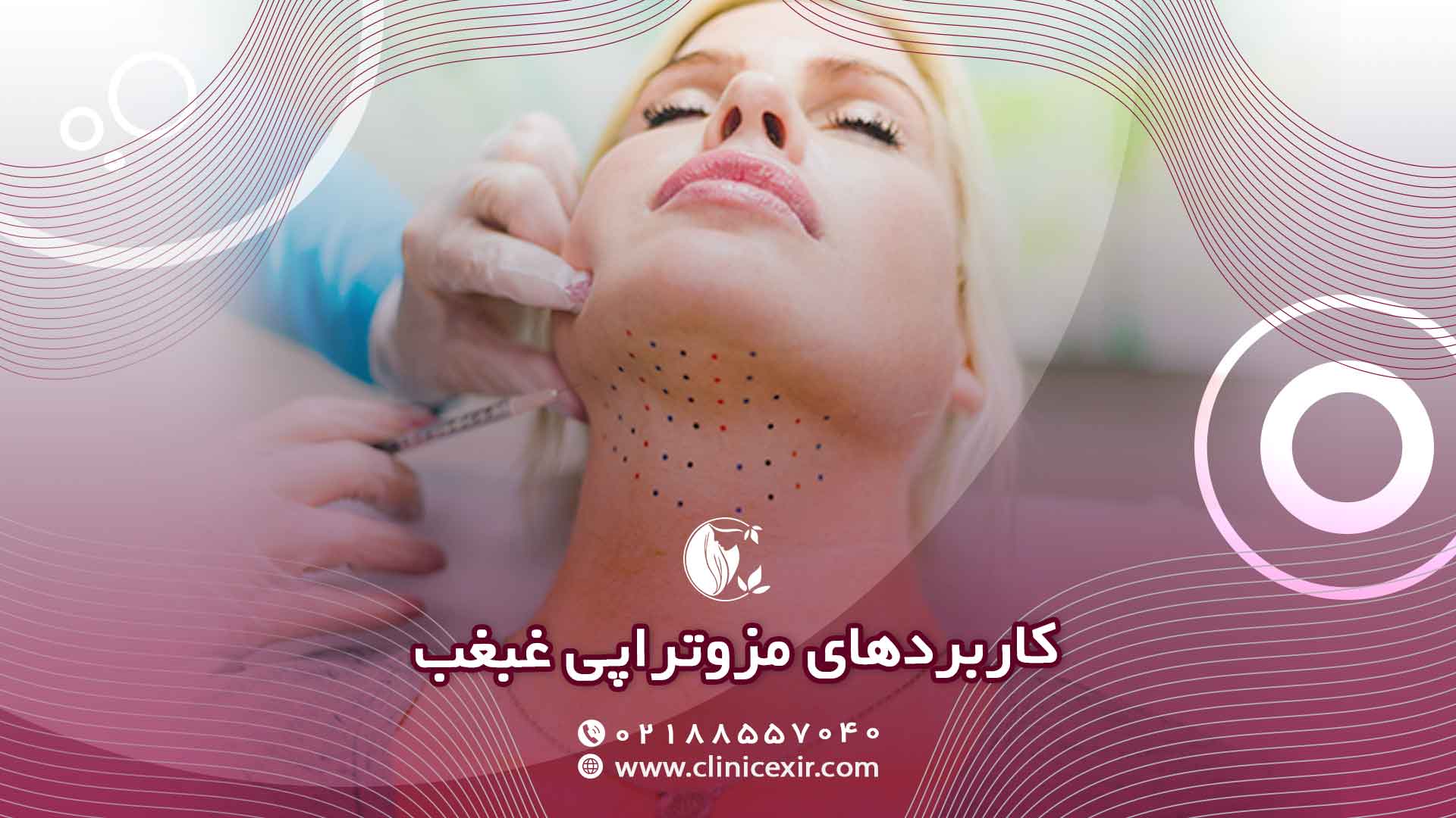 کاربرد مزوتراپی غبغب