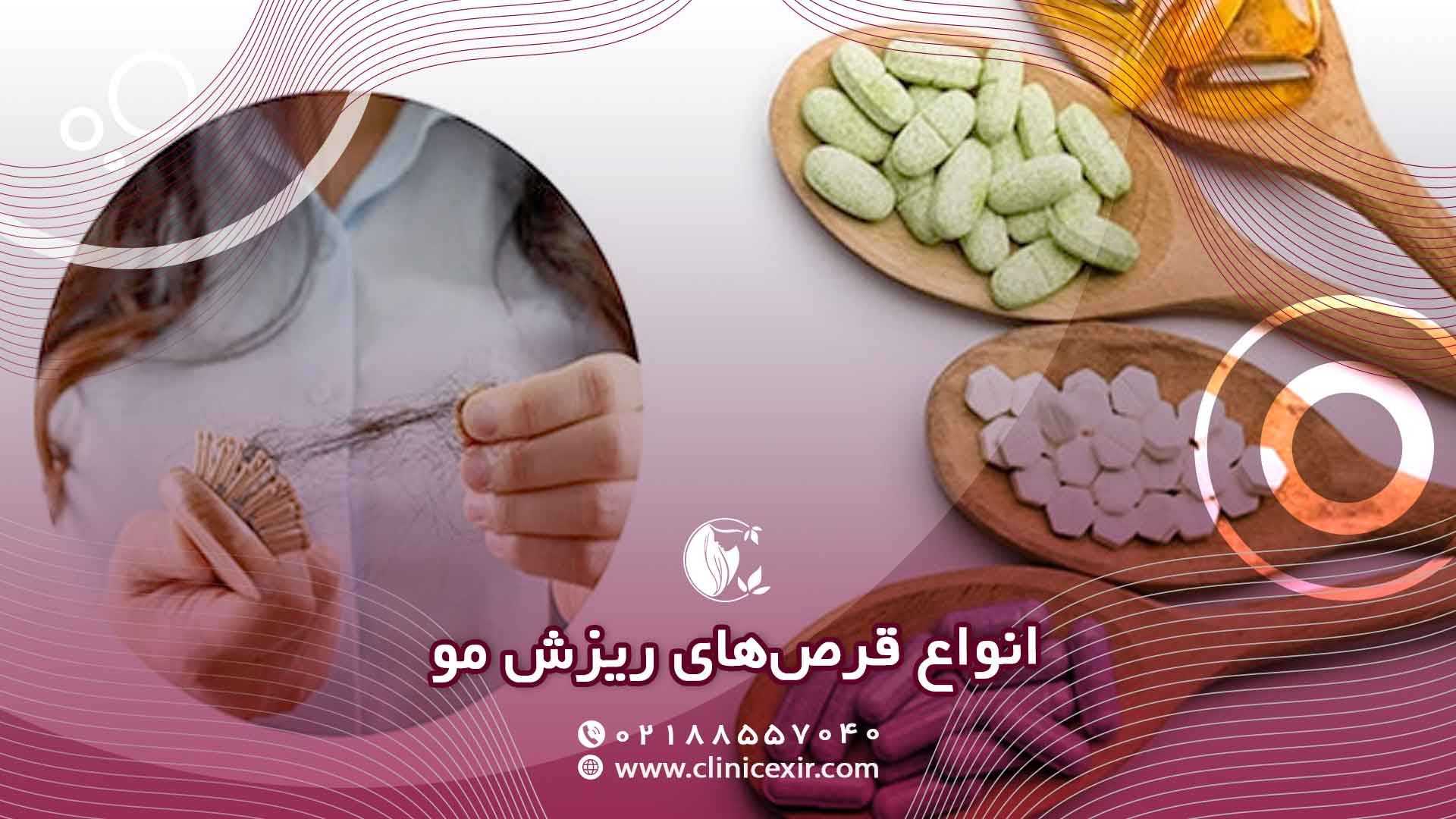 انواع اصلی قرص‌های ریزش مو