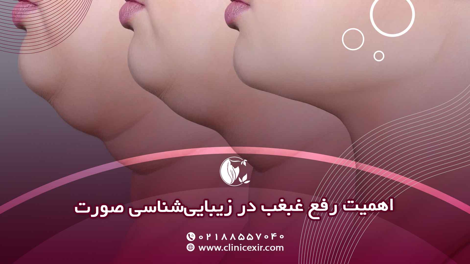 اهمیت رفع غبغب در زیبایی‌شناسی صورت