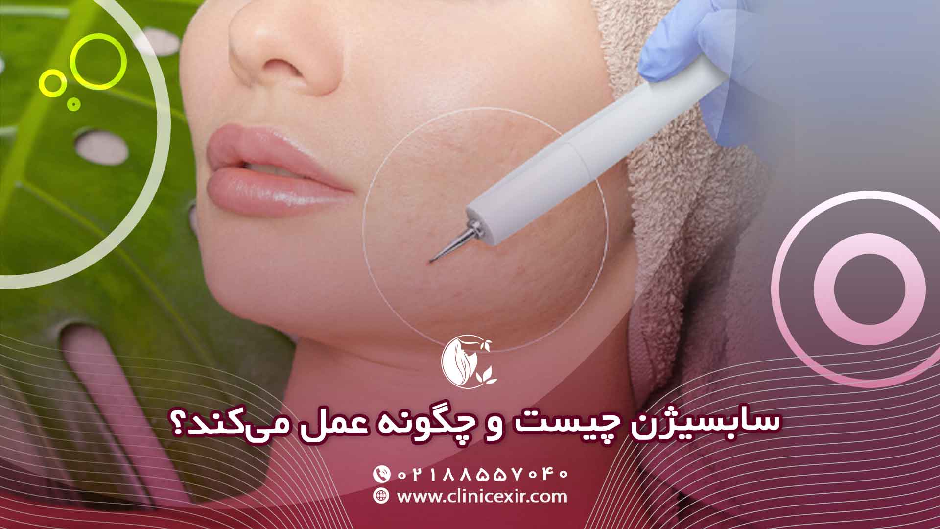 سابسیژن چگونه عمل می‌کند؟