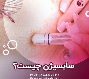 سابسیژن چیست