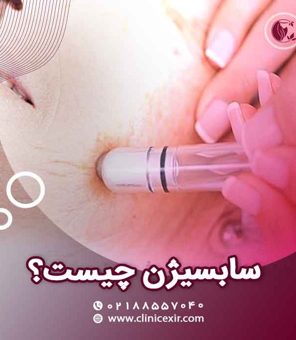 سابسیژن چیست