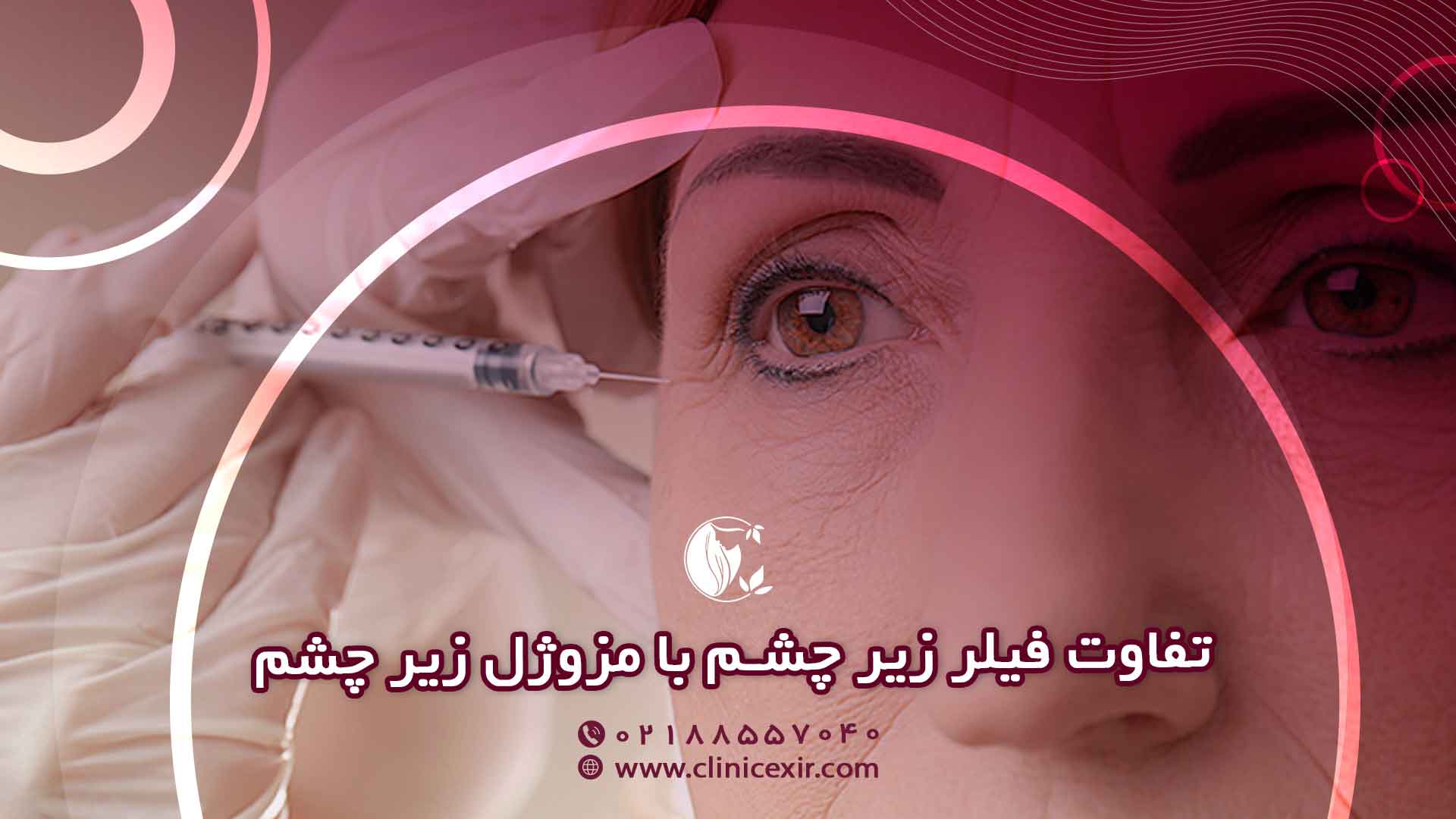 فرق فیلر زیر چشم با مزوژل زیر چشم چیست؟ (مقایسه جامع)