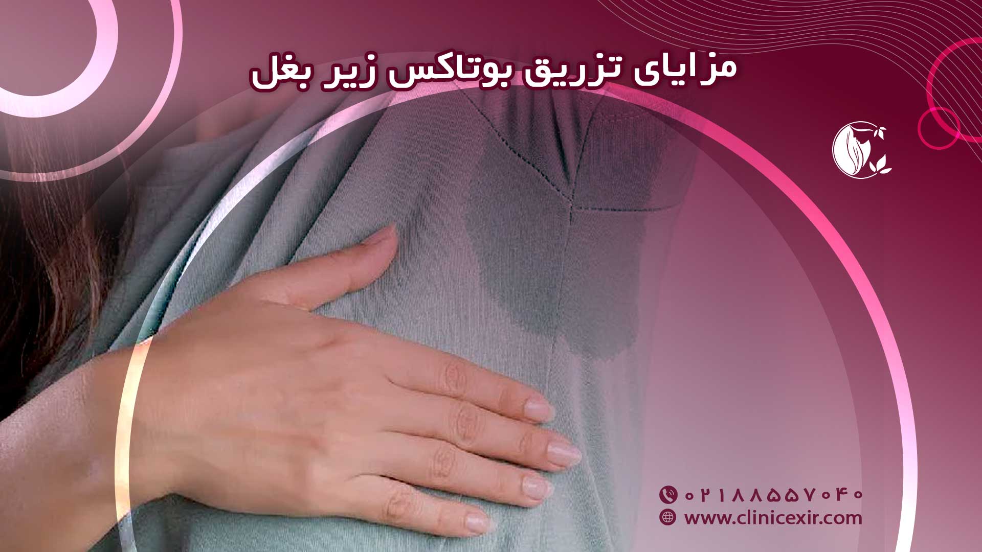 مزایای تزریق بوتاکس زیر بغل