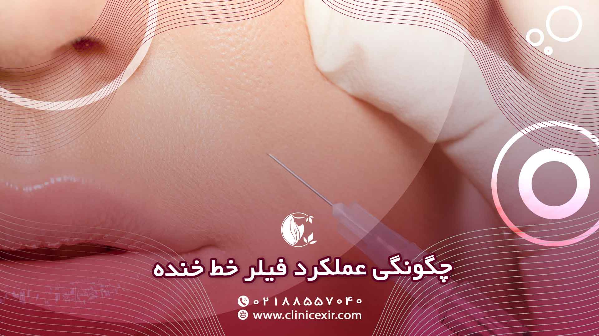 مکانیسم عمل ژل خط خنده