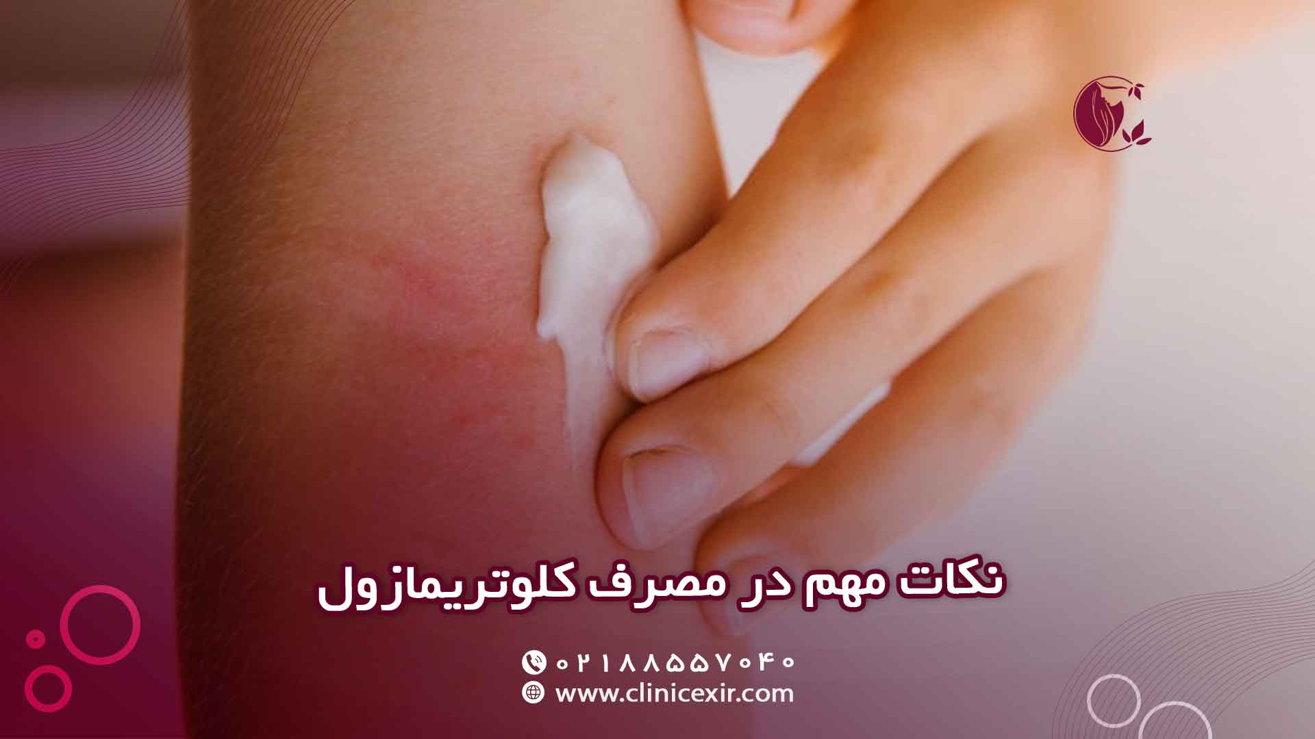 نکات مهم در مصرف کلوتریمازول