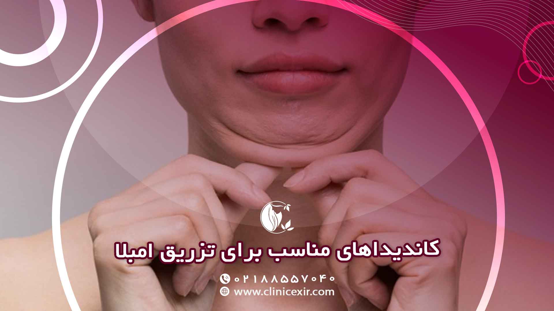 چه افرادی کاندیدای مناسب برای تزریق امبلا هستند؟
