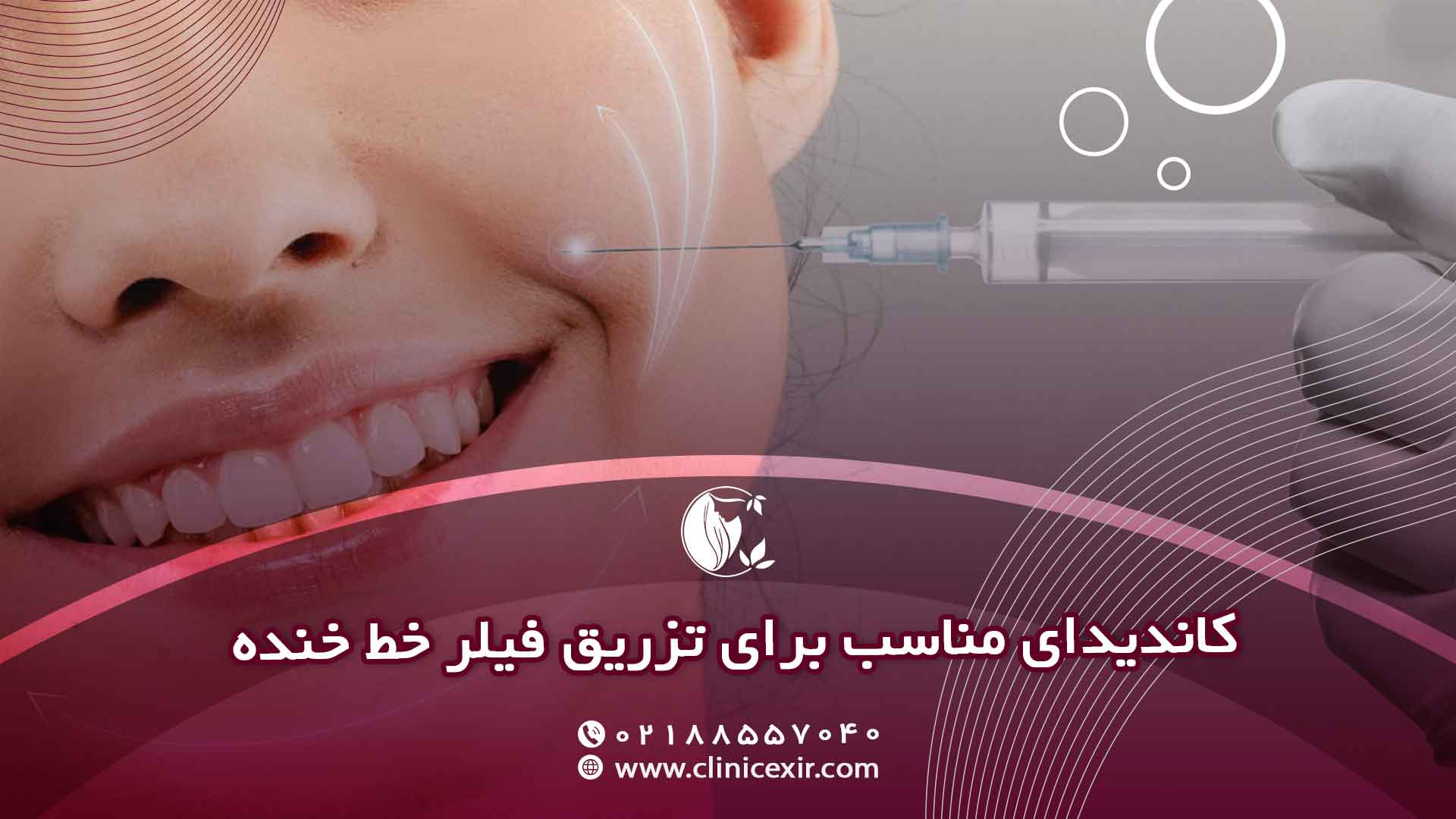 چه افرادی کاندیدای مناسب برای تزریق ژل خط خنده هستند؟