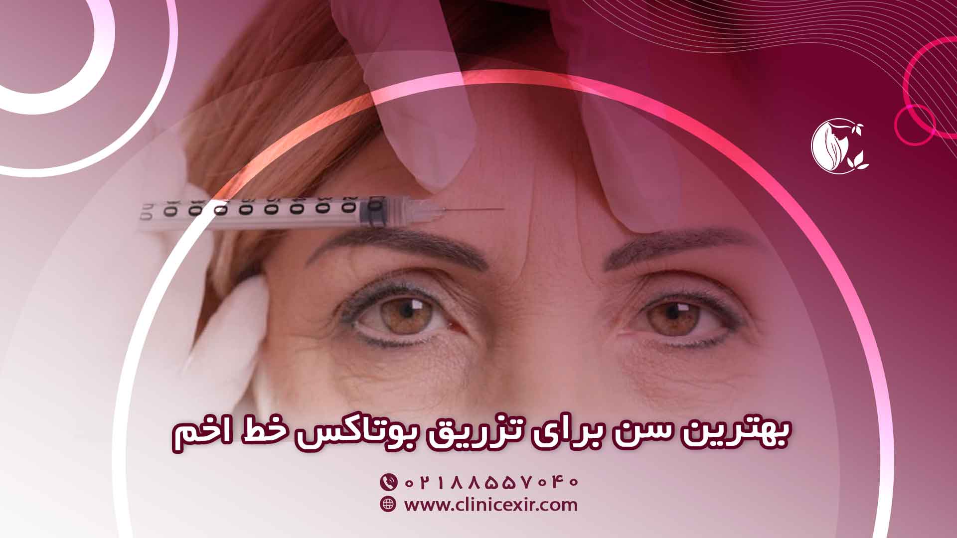 بهترین سن برای تزریق بوتاکس خط اخم 