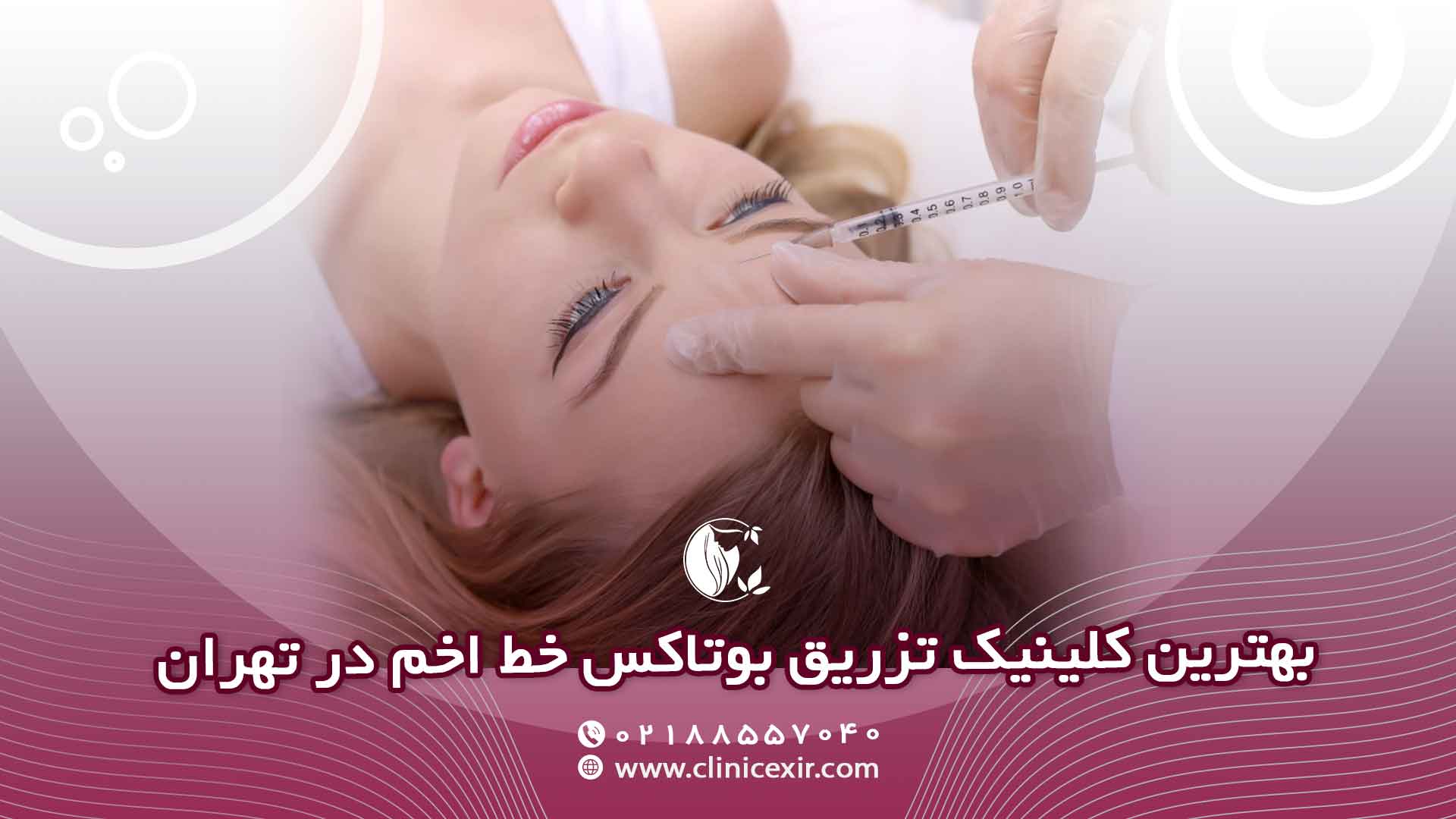 بهترین کلینیک تزریق بوتاکس خط اخم در تهران چرا کلینیک زیبایی اکسیر؟
