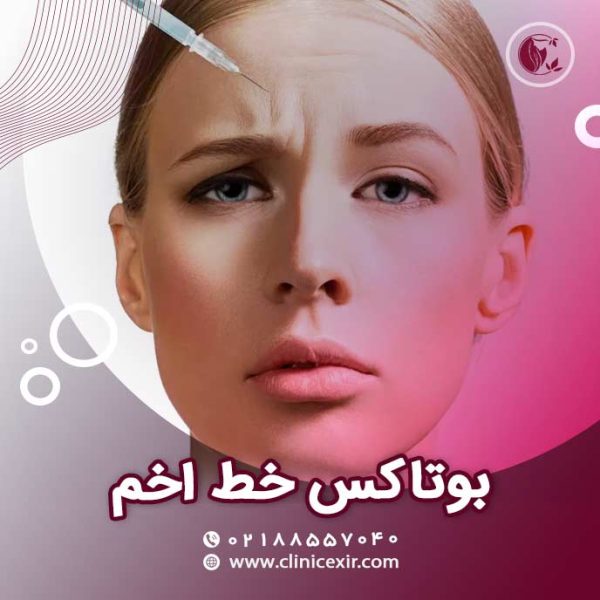 بوتاکس خط اخم