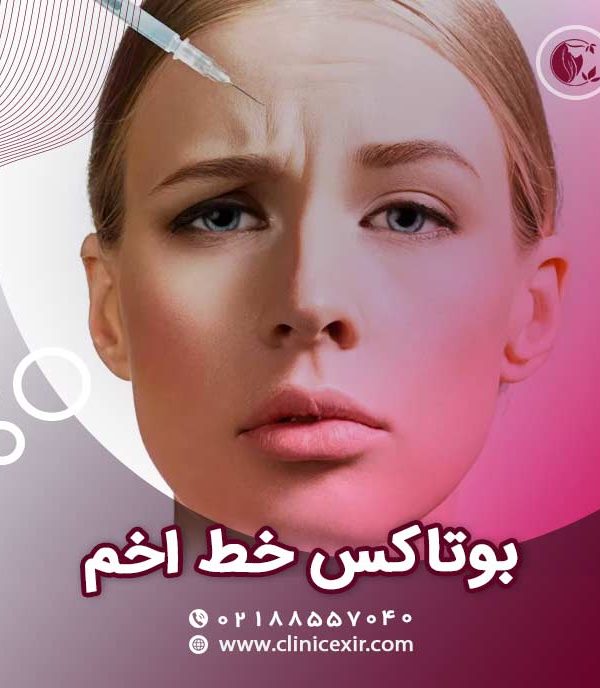 بوتاکس خط اخم