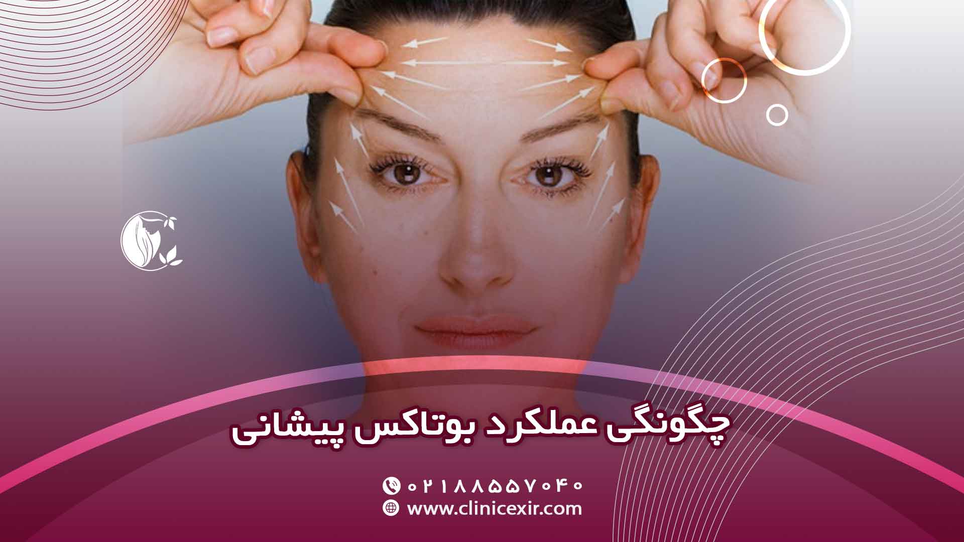 بوتاکس پیشانی چیست و چگونه عمل می‌کند؟