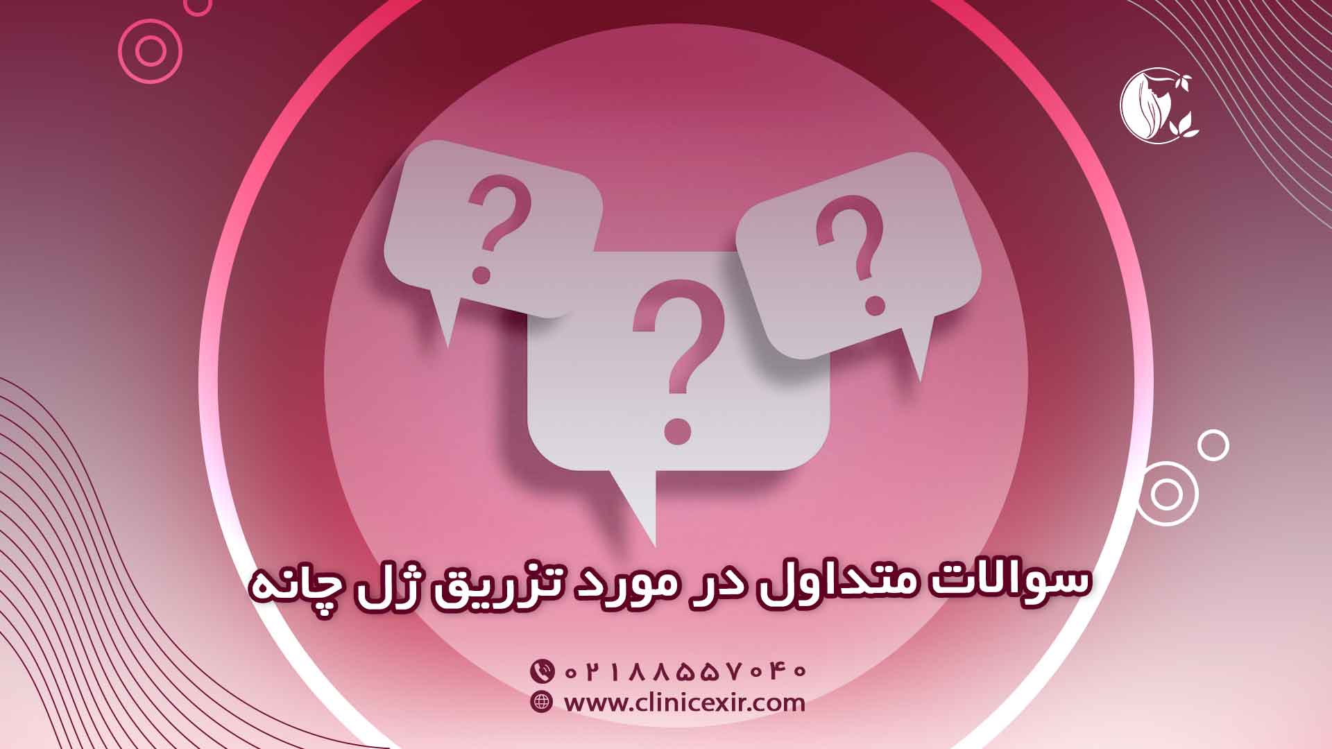سوالات رایج تزریق ژل چانه (FAQ)