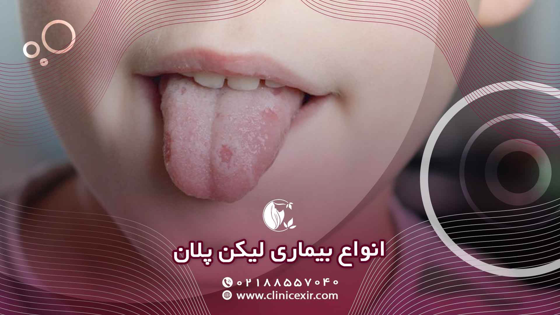 علائم لیکن پلان