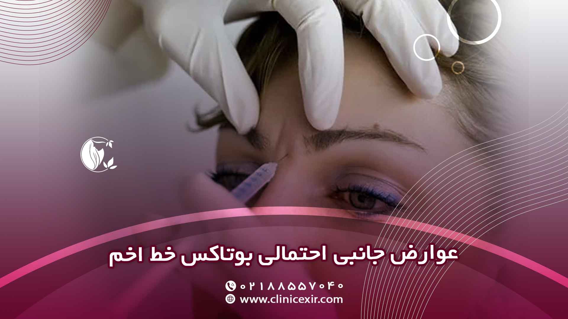 عوارض احتمالی بوتاکس خط اخم