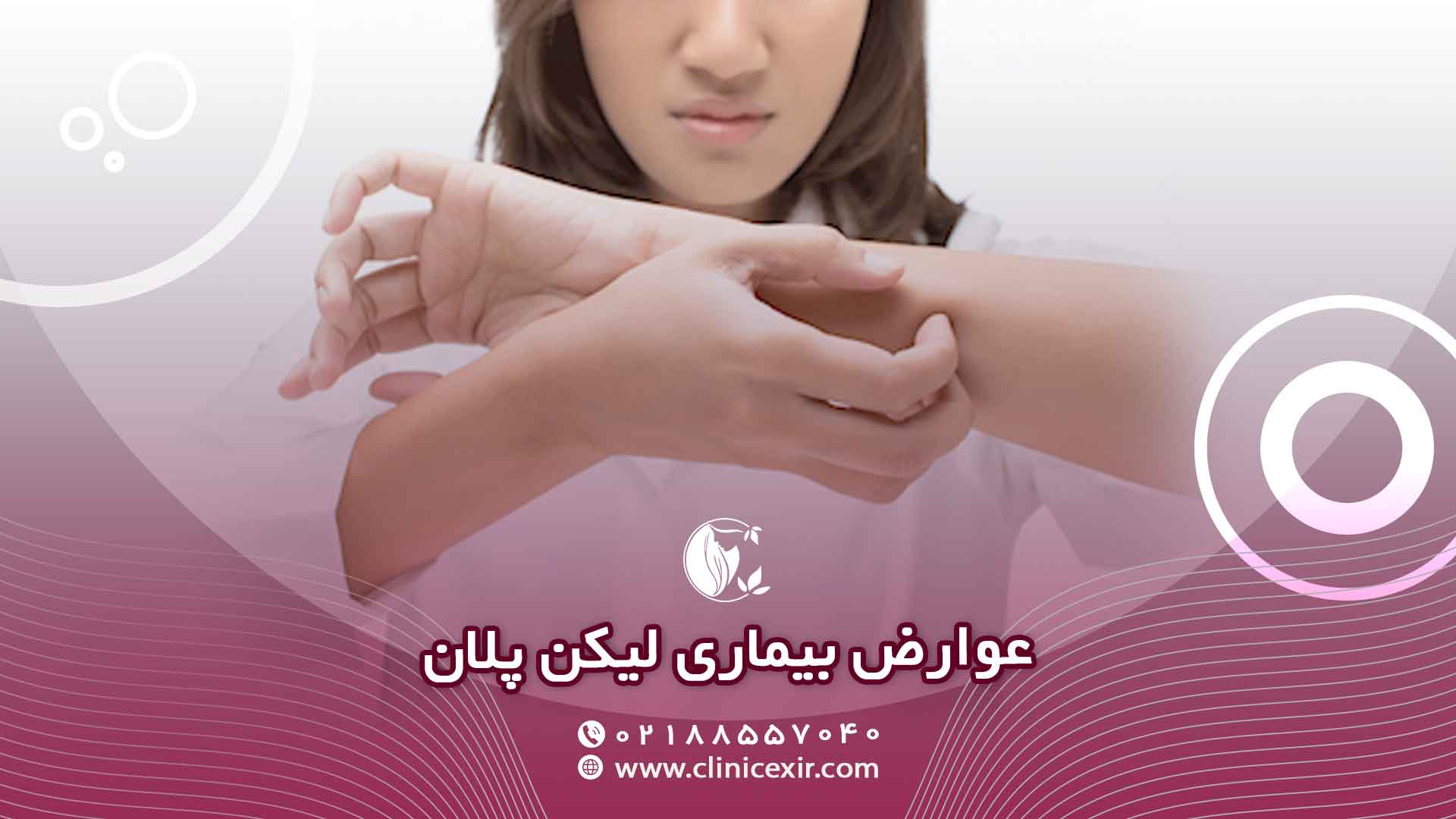 عوارض مهم لیکن پلان