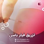 فیلر باسن