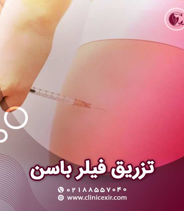 فیلر باسن
