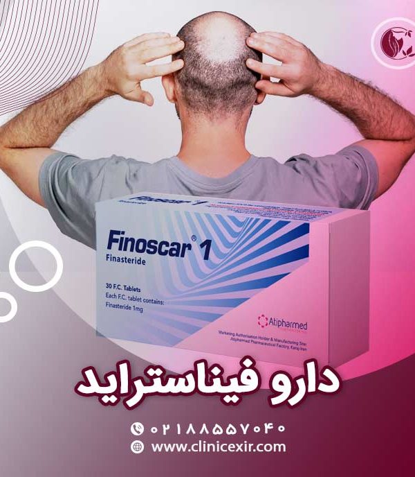 قرص فیناستراید